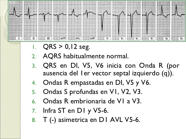 Onda R Embrionaria En D3 Y Avf