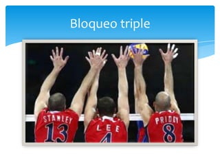 Bloqueo triple
 