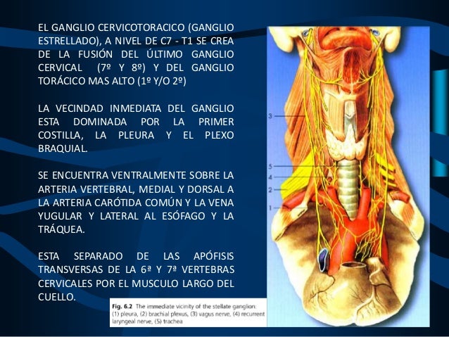 Bloqueo ganglio estrellado