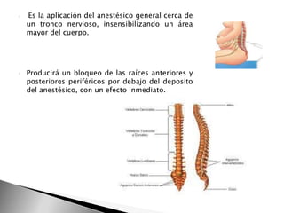 Bloqueo regional PPT