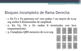 Bloqueo Incompleto de Rama Derecha
• 1. En V1 y V2 patrones rsr’ con ondas r’ no mayor de 0,04
seg ondas S disminuidas de amplitud.
• 2. En V5, V6 y D1 ondas S terminales con leve
empastamiento.
• 3. Complejos QRS menores de 0,12 seg.
 