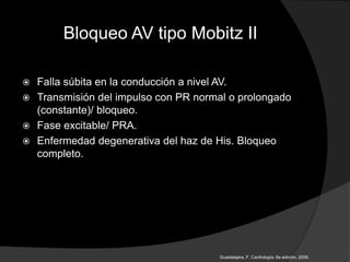 Bloqueo AV tipo Mobitz II
 Falla súbita en la conducción a nivel AV.
 Transmisión del impulso con PR normal o prolongado
(constante)/ bloqueo.
 Fase excitable/ PRA.
 Enfermedad degenerativa del haz de His. Bloqueo
completo.
Guadalajara, F. Cardiología. 6a edición, 2006.
 