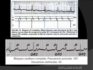 Guadalajara, F. Cardiología. 6a edición, 2006.
Ganong. Fisiologia Medica. 23a edición, 2010.
 