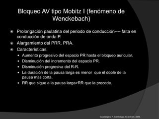 Bloqueo AV tipo Mobitz I (fenómeno de
Wenckebach)
 Prolongación paulatina del periodo de conducción---- falta en
conducción de onda P.
 Alargamiento del PRR. PRA.
 Características.
 Aumento progresivo del espacio PR hasta el bloqueo auricular.
 Disminución del incremento del espacio PR.
 Disminución progresiva del R-R.
 La duración de la pausa larga es menor que el doble de la
pausa mas corta.
 RR que sigue a la pausa larga>RR que la precede.
Guadalajara, F. Cardiología. 6a edición, 2006.
 