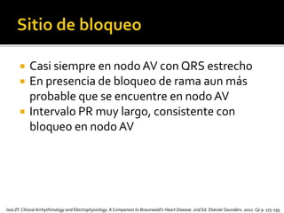  Casi siempre en nodo AV con QRS estrecho
 En presencia de bloqueo de rama aun más
probable que se encuentre en nodo AV
 Intervalo PR muy largo, consistente con
bloqueo en nodo AV
Issa ZF.Clinical Arrhythmology and Electrophysiology. A Companion to Braunwald’s Heart Disease. 2nd Ed. Elsevier Saunders. 2012. Cp 9. 175-195
 