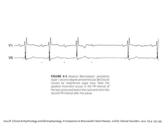 Issa ZF.Clinical Arrhythmology and Electrophysiology. A Companion to Braunwald’s Heart Disease. 2nd Ed. Elsevier Saunders. 2012. Cp 9. 175-195
 