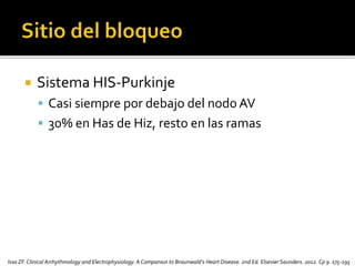  Sistema HIS-Purkinje
 Casi siempre por debajo del nodo AV
 30% en Has de Hiz, resto en las ramas
Issa ZF.Clinical Arrhythmology and Electrophysiology. A Companion to Braunwald’s Heart Disease. 2nd Ed. Elsevier Saunders. 2012. Cp 9. 175-195
 