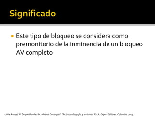 Este tipo de bloqueo se considera como
premonitorio de la inminencia de un bloqueo
AV completo
Uribe Arango W. Duque Ramírez M. Medina Durango E. Electrocardiografía y arritmias. P. LA.Export Editores. Colombia. 2005.
 