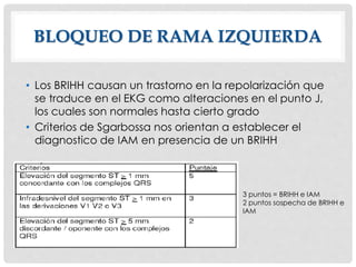 3 puntos = BRIHH e IAM
2 puntos sospecha de BRIHH e
IAM
BLOQUEO DE RAMA IZQUIERDA
• Los BRIHH causan un trastorno en la repolarización que
se traduce en el EKG como alteraciones en el punto J,
los cuales son normales hasta cierto grado
• Criterios de Sgarbossa nos orientan a establecer el
diagnostico de IAM en presencia de un BRIHH
 