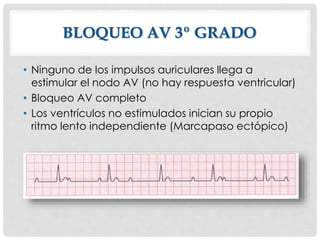 BLOQUEO AV 3º GRADO
• Ninguno de los impulsos auriculares llega a
estimular el nodo AV (no hay respuesta ventricular)
• Bloqueo AV completo
• Los ventrículos no estimulados inician su propio
ritmo lento independiente (Marcapaso ectópico)
 