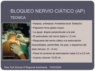 BLOQUEO NERVIO CIÁTICO (AP)
     TÉCNICA
                        • Asepsia, antisepsia. Anestesia local. Sedación.
       ...