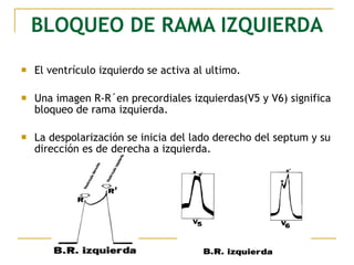 BLOQUEO DE RAMA IZQUIERDA
 El ventrículo izquierdo se activa al ultimo.
 Una imagen R-R´en precordiales izquierdas(V5 y V6) significa
bloqueo de rama izquierda.
 La despolarización se inicia del lado derecho del septum y su
dirección es de derecha a izquierda.
 