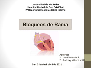 Universidad de los Andes
Hospital Central de San Cristóbal
IV Departamento de Medicina Interna
Bloqueos de Rama
Autores:
1. José Valencia R1
2. Andrexy Villamizar R2
San Cristóbal, abril de 2022
 