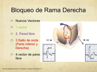 Bloqueo de Rama Derecha
Nuevos Vectores
1.septal
2. Pared libre
3.Salto de onda
(Parte inferior y
Derecha)
4.vector de pared
libre
Electrocardiografía clínica C. Castellanos 2 edición 2004 pp:69-74
 
