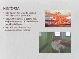 HISTORIA
• 1899 Dudley Tait y Guido Caglieri,
sales mercúricas y yoduros.
• 1907, Arthur Barker la esterilidad,
longitud media sin cánula de níquel
y con bisel afilado
• 1946, Adriani y Roman-Vega
bloqueo en silla de montar
 