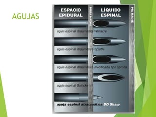 AGUJAS 
 