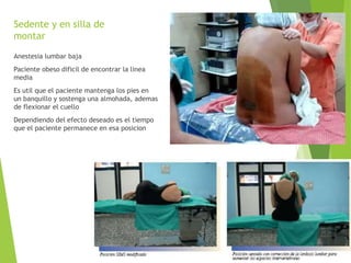 Sedente y en silla de 
montar 
Anestesia lumbar baja 
Paciente obeso dificil de encontrar la linea 
media 
Es util que el paciente mantenga los pies en 
un banquillo y sostenga una almohada, ademas 
de flexionar el cuello 
Dependiendo del efecto deseado es el tiempo 
que el paciente permanece en esa posicion 
 