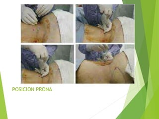 POSICION PRONA 
 