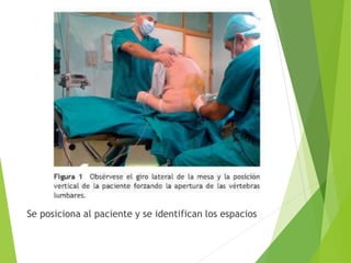 Se posiciona al paciente y se identifican los espacios 
 