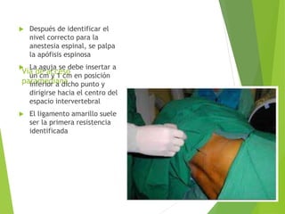  Después de identificar el 
nivel correcto para la 
anestesia espinal, se palpa 
la apófisis espinosa 
 La aguja se debe insertar a 
Vía de acceso 
paramediana 
un cm y 1 cm en posición 
inferior a dicho punto y 
dirigirse hacia el centro del 
espacio intervertebral 
 El ligamento amarillo suele 
ser la primera resistencia 
identificada 
 