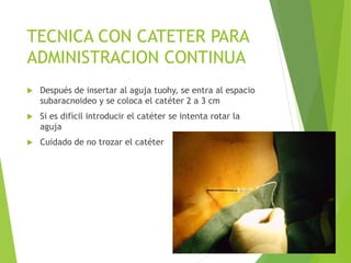 TECNICA CON CATETER PARA 
ADMINISTRACION CONTINUA 
 Después de insertar al aguja tuohy, se entra al espacio 
subaracnoideo y se coloca el catéter 2 a 3 cm 
 Si es difícil introducir el catéter se intenta rotar la 
aguja 
 Cuidado de no trozar el catéter 
 
