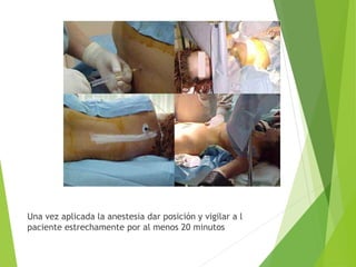 Una vez aplicada la anestesia dar posición y vigilar a l 
paciente estrechamente por al menos 20 minutos 
 