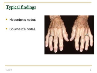 Typical findings

   Heberden’s nodes

   Bouchard’s nodes




03/08/13               22
 