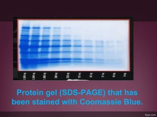 Protein gel (SDS-PAGE) that has
been stained with Coomassie Blue.
 