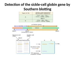 Detection of the sickle-cell globin gene by
Southern blotting
 