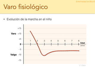 Varo fisiológico
• Evolución de la marcha en el niño
Enfermedad de Blount
C. Calvo
 