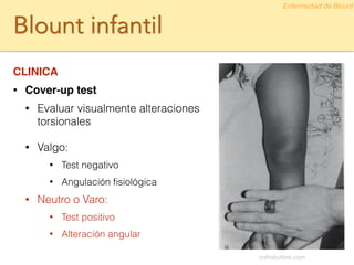 Blount infantil
CLINICA!
• Cover-up test
• Evaluar visualmente alteraciones
torsionales
!
• Valgo:
• Test negativo
• Angulación ﬁsiológica
• Neutro o Varo:
• Test positivo
• Alteración angular
Enfermedad de Blount
orthobullets.com
 