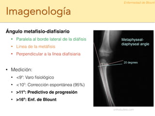 Imagenología
Ángulo metaﬁsio-diaﬁsiario!
• Paralela al borde lateral de la diáﬁsis
• Linea de la metáﬁsis
• Perpendicular a la línea diaﬁsiaria
!
• Medición:
• <9º: Varo ﬁsiológico
• <10º: Corrección espontánea (95%)
• >11º: Predictivo de progresión!
• >16º: Enf. de Blount
Enfermedad de Blount
orthobullets.com
 