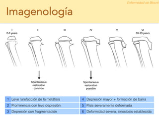 Imagenología
1 Leve rarefacción de la metáﬁsis 4 Depresión mayor + formación de barra
2 Prominencia con leve depresión 5 FIsis severamente deformada
3 Depresión con fragmentación 6 Deformidad severa, sinostosis establecida
Enfermedad de Blount
 