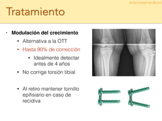 Tratamiento
• Modulación del crecimiento!
• Alternativa a la OTT
• Hasta 90% de corrección
• Idealmente detectar
antes de 4 años
• No corrige torsión tibial
!
• Al retiro mantener tornillo
epiﬁsiario en caso de
recidiva
Enfermedad de Blount
 
