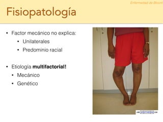Fisiopatología
• Factor mecánico no explica:
• Unilaterales
• Predominio racial
!
• Etiología multifactorial!!
• Mecánico
• Genético
Enfermedad de Blount
 