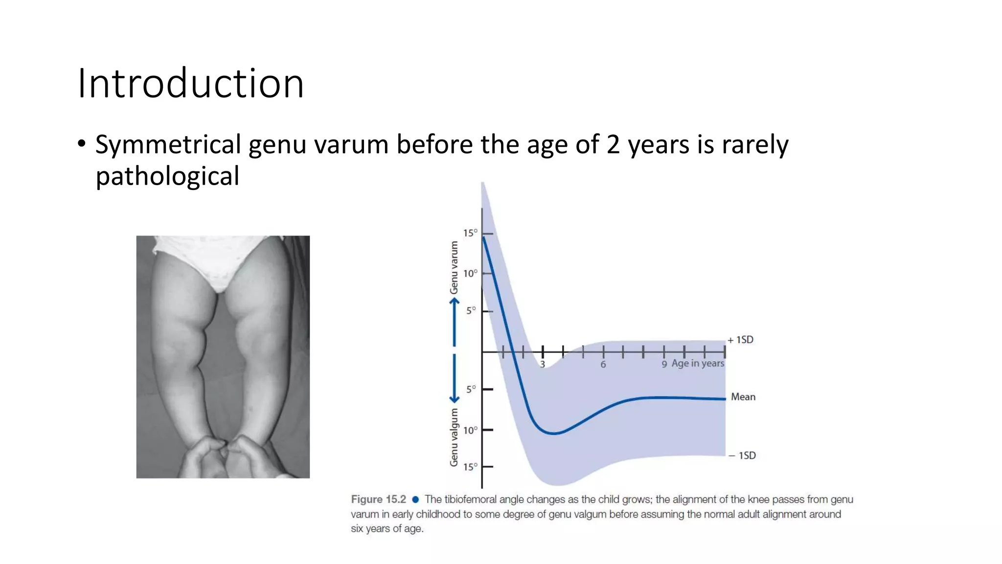 blount disease pptx | PPTX