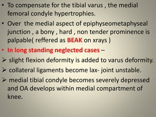 Blounts disease | PPTX