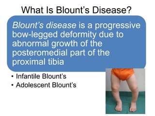 BLOUNT’S DISEASE.pptx