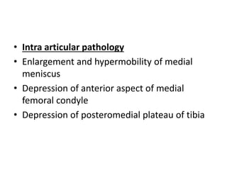 • Intra articular pathology
• Enlargement and hypermobility of medial
meniscus
• Depression of anterior aspect of medial
femoral condyle
• Depression of posteromedial plateau of tibia
 