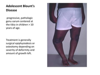 Adolescent Blount's
Disease
progressive, pathologic
genu varum centered at
the tibia in children > 10
years of age.
Treatment is generally
surgical epiphysiodesis or
osteotomy depending on
severity of deformity and
amount of growth left.
 