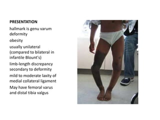 PRESENTATION
hallmark is genu varum
deformity
obesity
usually unilateral
(compared to bilateral in
infantile Blount's)
limb-length discrepancy
secondary to deformity
mild to moderate laxity of
medial collateral ligament
May have femoral varus
and distal tibia valgus
 