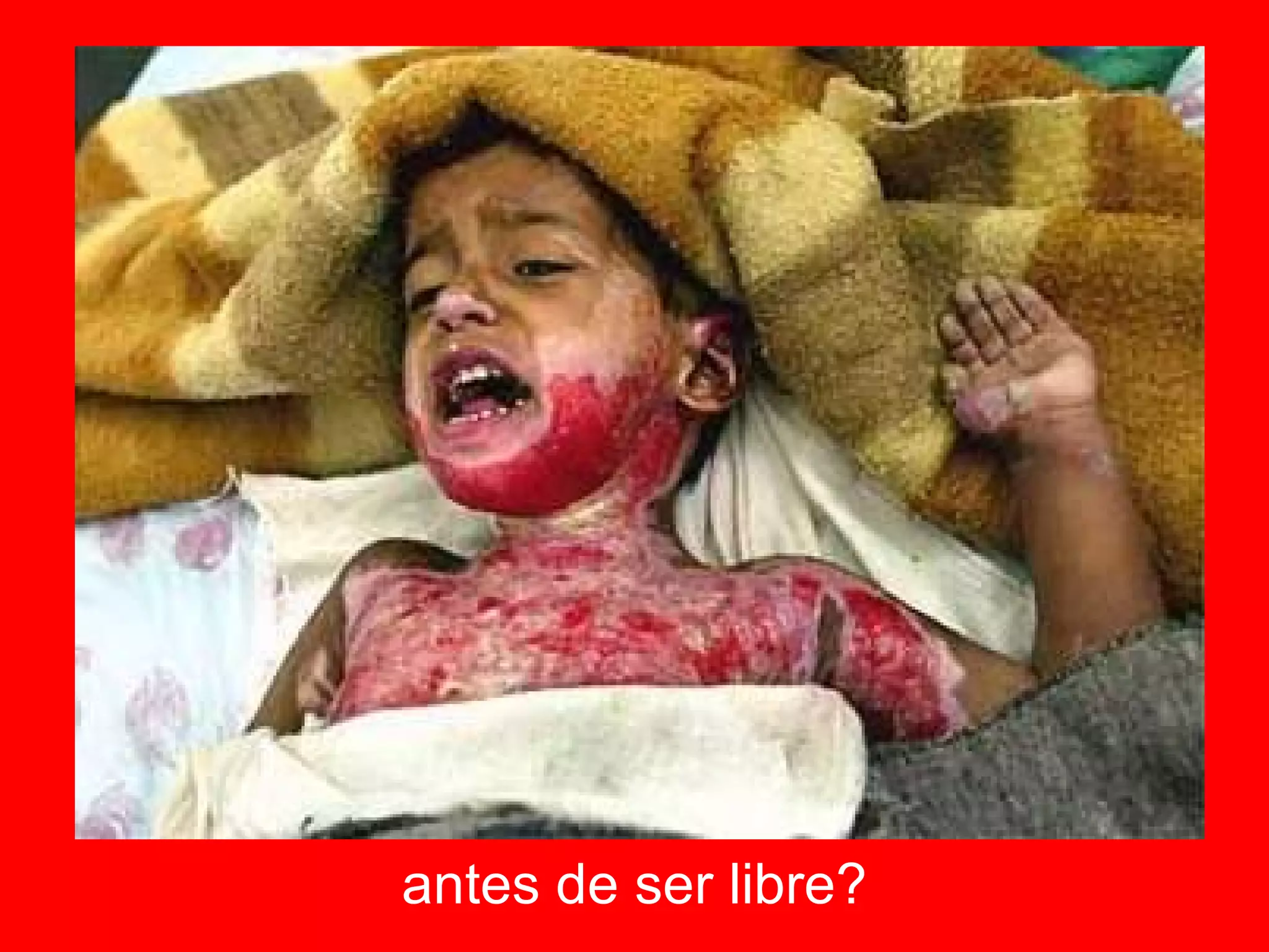 antes de ser libre? 