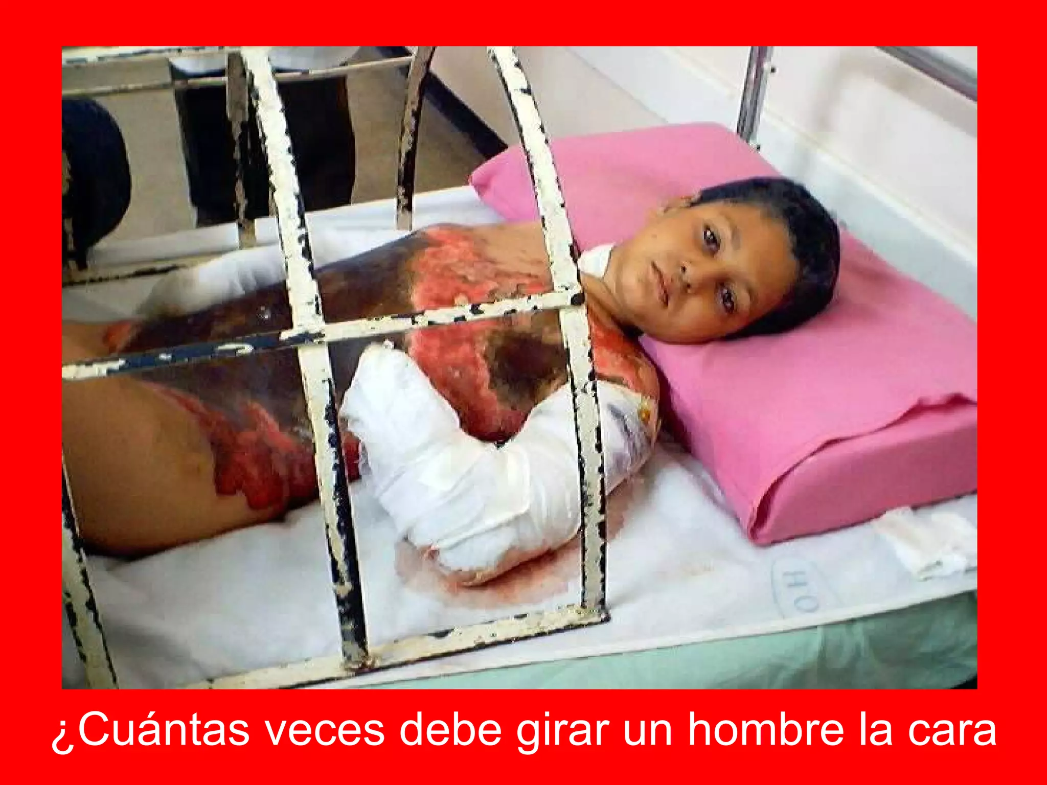 ¿Cuántas veces debe girar un hombre la cara 