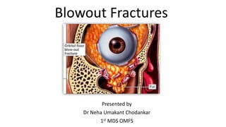 Blowout Fractures
Presented by
Dr Neha Umakant Chodankar
1st MDS OMFS
 