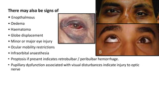 There may also be signs of
• Enopthalmous
• Oedema
• Haematoma
• Globe displacement
• Minor or major eye injury
• Ocular mobility restrictions
• Infraorbital anaesthesia
• Proptosis if present indicates retrobulbar / peribulbar hemorrhage.
• Pupillary dysfunction associated with visual disturbances indicate injury to optic
nerve
 