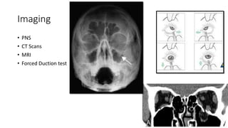 Imaging
• PNS
• CT Scans
• MRI
• Forced Duction test
 