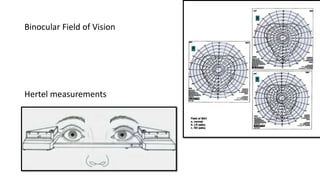 Binocular Field of Vision
Hertel measurements
 