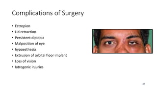 37
Complications of Surgery
• Ectropion
• Lid retraction
• Persistent diplopia
• Malposition of eye
• hypoesthesia
• Extrusion of orbital floor implant
• Loss of vision
• Iatrogenic injuries
 