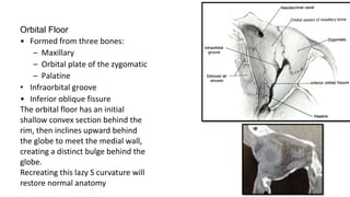 Orbital Floor
• Formed from three bones:
– Maxillary
– Orbital plate of the zygomatic
– Palatine
• Infraorbital groove
• Inferior oblique fissure
The orbital floor has an initial
shallow convex section behind the
rim, then inclines upward behind
the globe to meet the medial wall,
creating a distinct bulge behind the
globe.
Recreating this lazy S curvature will
restore normal anatomy
 
