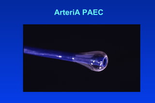 ArteriA PAEC
 